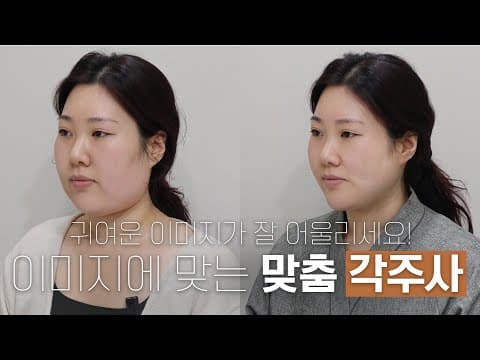 Custom Contour Injections to Refine Your Face: Cute or Mature Design