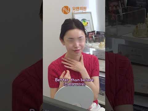 他院轮廓三件套术后修复，爱马仕级蜕变：奢牌级效果真实记录