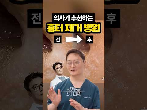 쌍꺼풀, 앞트임 수술 후 남은 흉터 치료 잘하는 원장님