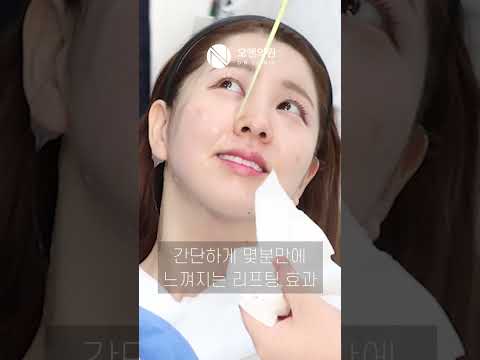 オーアン チタンリフティングで凹凸のある顔のラインを改善した後のレビュー