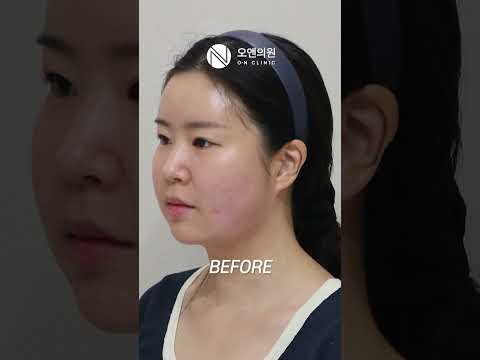 얼굴살 싹! 빼주는 각주사, 아직 모른다고? Live My Life