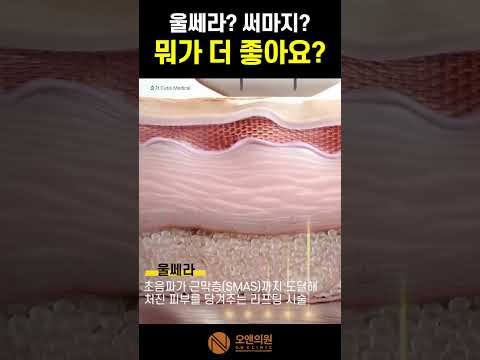 ウルセラ？サーマクール？何がそんなに良い？2つの違いと選び方