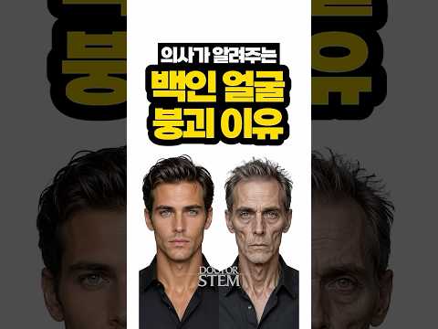 동갑인데 왜 외국인이 더 늙어 보일까요?
