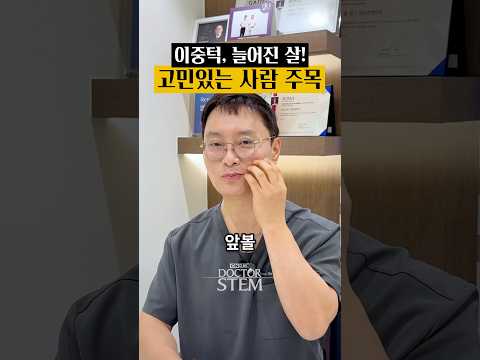 双下巴皮肤松弛有烦恼请注意：Dr.Stem有效方案