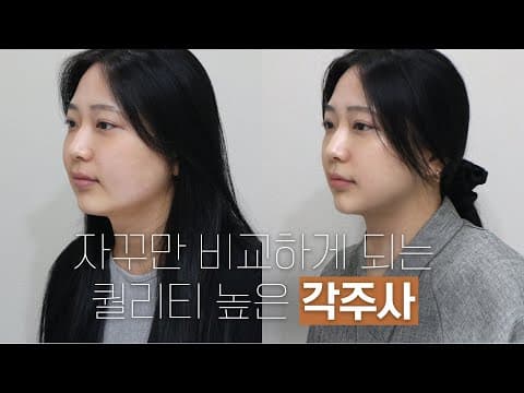O& Contour Injection Results: Before & After of Unmatched Quality
