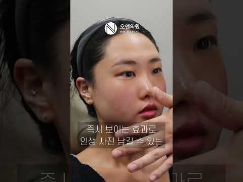 日本のお客様も訪れる芸能人リフティング チタン：K-BEAUTYの頂点
