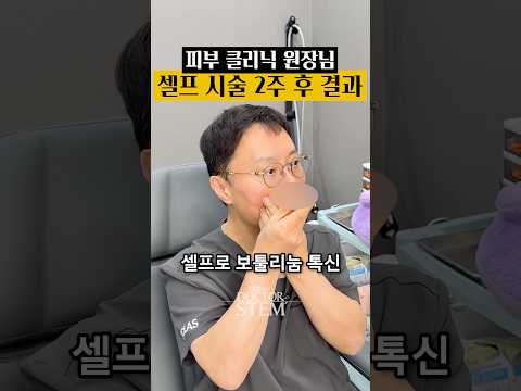 피부과 원장님의 보툴리눔 톡신 셀프 시술 2주 후기