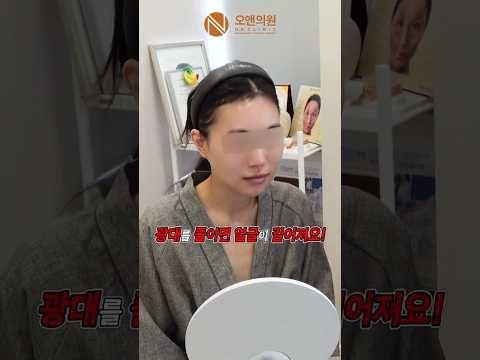 광대뼈 수술 후 얼굴 변화와 환자 만족도: '이거' 줄여 200%