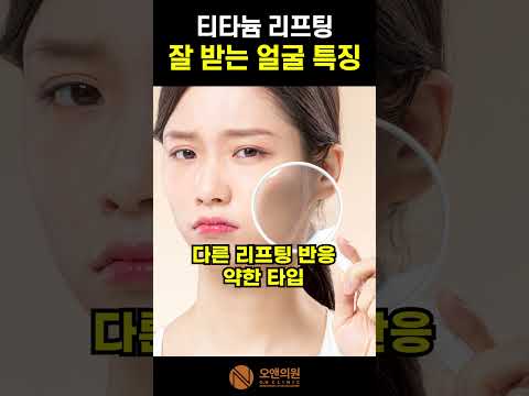 钛提升效果好的面部特征：适合人群与提升效果技巧