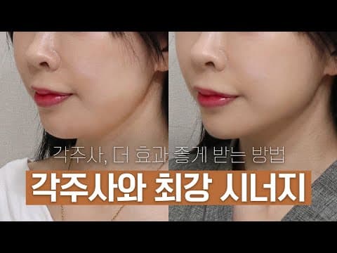 ON Clinic Angle Injection Review and Synergy Effects for Better Results