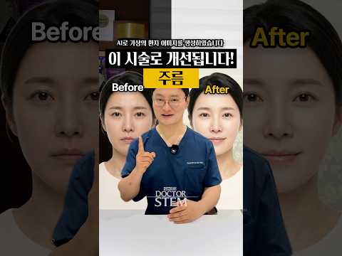 这种疗程能改善！皱纹烦恼由Dr.STEM亲自解答