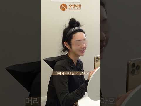 颧骨修复手术：改善阶梯状畸形与面部缩小，明星电视剧案例