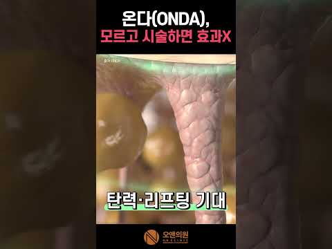 ONDA Treatment Explained: Who It Suits and How to Maximize Results