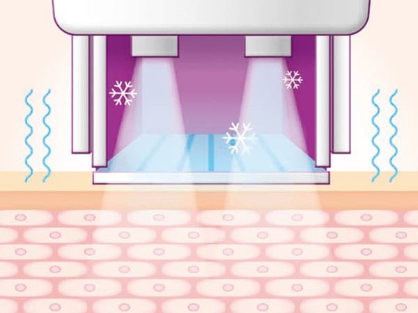 STEP 02: Vibration and Cooling Start