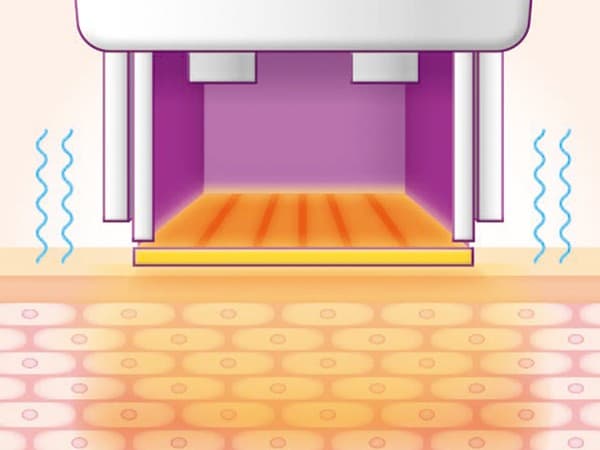 STEP 03: RF Energy Penetration