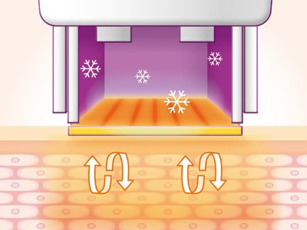 STEP 04: Cooling System Maintenance