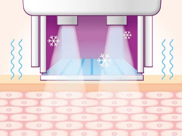 STEP 05: Final Cooling