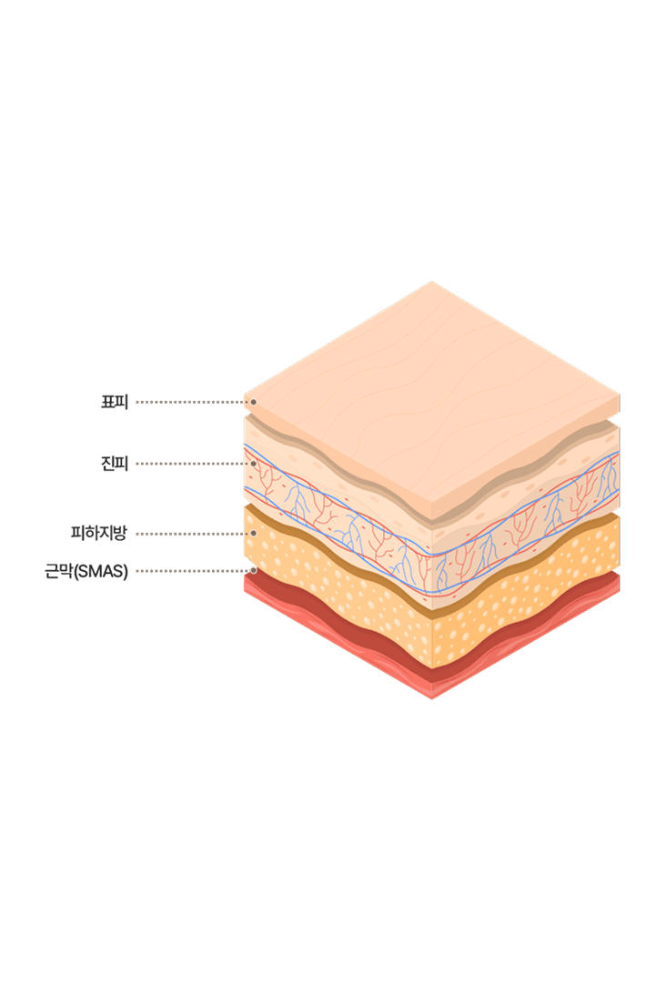 Layer-by-Layer Lifting Design