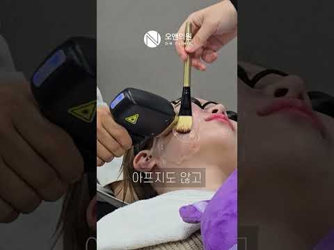 Titanium Lifting Review: Instant, Pain-Free Results I Want Again