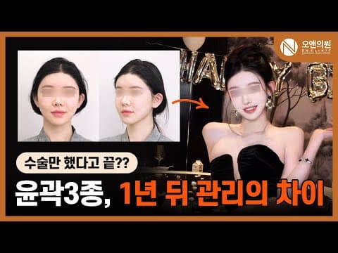 ON Facial Contouring: Midface Reduction Plus V-line, One-Year Aftercare