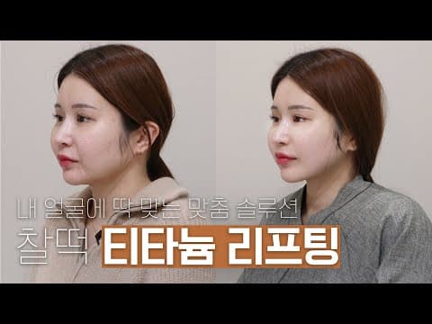 ON Clinic Titanium Lifting: A Tailored Solution That Fits Your Face
