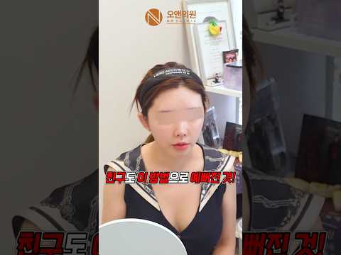 Mid-Face Reduction Review: Deciding After Seeing a Friend's Result