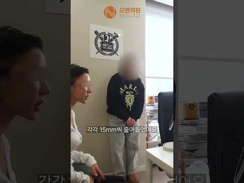 頭が大きい患者様の頬骨縮小術レビュー:大きな頭を小さくする方法