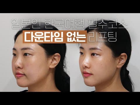 A Must-Do Course for Japanese Travelers in Korea: No-Downtime Titanium Lifting