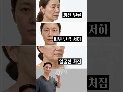 Recommended Treatments by Skin Aging Concern: A 6-Second Quick Guide