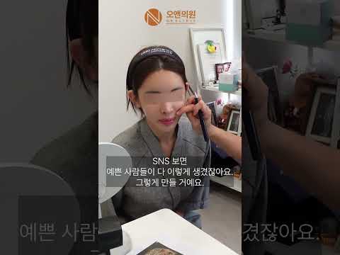 Challenges and Results of Facial Contouring Surgery for Thin Skin