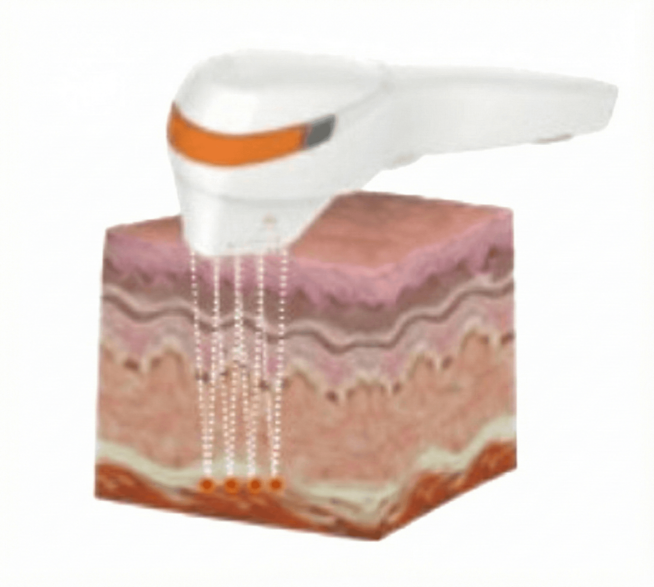 Immediate Post-Treatment Effect