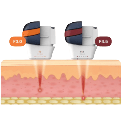 Ultrasound Cartridges Selectable by Target Depth