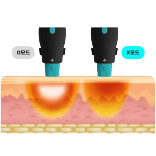 G/X Dual Mode Selectable by Delivery Range